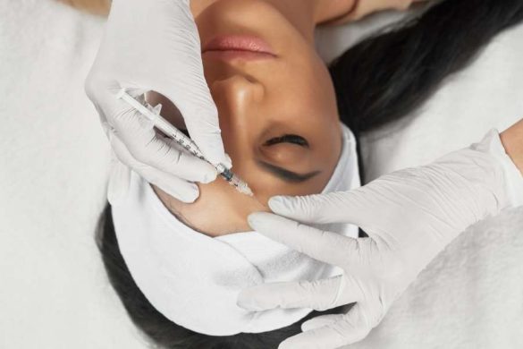 Injection de médecine esthétique réalisée par un praticien ganté avec une seringue sur le visage d'une femme allongée aux yeux fermés